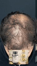 HAIR+ ANTICAIDA DE CABELLO